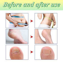 Load image into Gallery viewer, Foot Bath Tablets Dispelling Dampness Relieving Fatigue Promoting Metabolism Cleaning Feet Instant Foot Care Bath Tablets