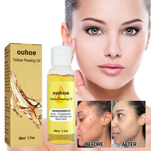 Load image into Gallery viewer, Whitening Exfoliating Oil Deep Cleansing Exfoliating Dead Skin Fading Spots Brightening Complexion Skin Care Oil