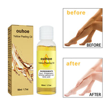 Load image into Gallery viewer, Whitening Exfoliating Oil Deep Cleansing Exfoliating Dead Skin Fading Spots Brightening Complexion Skin Care Oil
