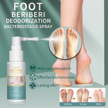Load image into Gallery viewer, Foot Beriberi Spray Foot Itching Foot Odor Sweat Foot Care Liquid Mild Non Irritating Antibacterial Foot Spray