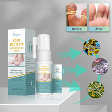 Load image into Gallery viewer, Foot Beriberi Spray Foot Itching Foot Odor Sweat Foot Care Liquid Mild Non Irritating Antibacterial Foot Spray