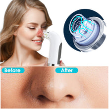 Load image into Gallery viewer, Small Bubble Beauty Instrument Household Pore Cleaning Introduction Oxygen Injection Instrument Electric Blackhead Removal Artifact