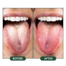Load image into Gallery viewer, Silicone Tongue Scraping Brush Clean Oral Tongue Coating Remove Smell Double Sided Tongue Cleaning Brush Oral Health Care