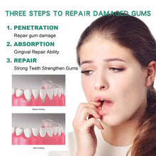 Load image into Gallery viewer, Gingival Repair Drops Reducing Inflammation Discomfort Relieving Dental Problems Oral Cleaning Care Drops