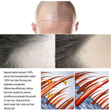 Load image into Gallery viewer, Hair Growth Oil Prevent Hair Loss Strengthen Hair Care Prevent Hair Breakage Ginger Hair Care Damage Repair Hair Care
