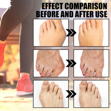Load image into Gallery viewer, Anti-bunions Health Sock Promoting Blood Circulation Reducing Pain Swelling Relaxing Joints Comfortable Breathable Foot Care Sock