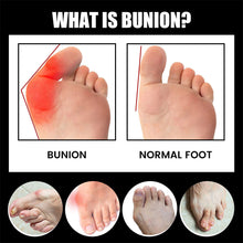 Load image into Gallery viewer, Anti-bunions Health Sock Promoting Blood Circulation Reducing Pain Swelling Relaxing Joints Comfortable Breathable Foot Care Sock