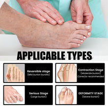Load image into Gallery viewer, Anti-bunions Health Sock Promoting Blood Circulation Reducing Pain Swelling Relaxing Joints Comfortable Breathable Foot Care Sock