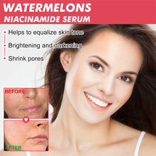 Load image into Gallery viewer, Watermelon Glow Nicotinamide Facial Moisturizing&Brightening Essence Women's Spot Lightening Essence Highlighter