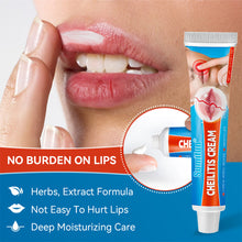 Load image into Gallery viewer, Cheilitis Cream Relieving Lip Discomfort Promoting Lip Health Moisturizing Lip Fading Lip Lines Health Care Cream