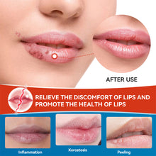 Load image into Gallery viewer, Cheilitis Cream Relieving Lip Discomfort Promoting Lip Health Moisturizing Lip Fading Lip Lines Health Care Cream