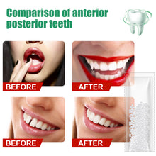 Load image into Gallery viewer, Resin Tooth Repair Glue Shapeable Teeth Gaps Glue Solid Special Effect Makeup Denture Modification Temporary Teeth Filling Glue