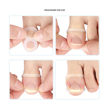 Load image into Gallery viewer, Ingrown Toenail Corrector Ring Elastic Washable Reusable Toenail Correction Silicone Ring Paronychia Restoration Tool