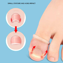 Load image into Gallery viewer, Ingrown Toenail Corrector Ring Elastic Washable Reusable Toenail Correction Silicone Ring Paronychia Restoration Tool
