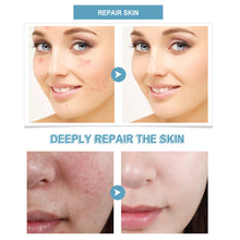 Load image into Gallery viewer, Hyaluronic Acid Serum Facial Essence Super Hydrating Repair Skin Deep Repair Moisturizing Facial Skin Anti-aging Essence Korean Skin Care Products