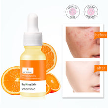 Load image into Gallery viewer, Skincare Products Vitamin C Facial Serum Brighten Skin Lighten Spots Hyaluronic Acid Face Essence Anti-aging Skin Care Products 15ml