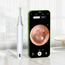Load image into Gallery viewer, Soft Rechargeable Intelligent Wireless Visual Ear Pick Luminous HD Ear Endoscope Silicone Ear Spoon Ear Wax Cleaning Tool