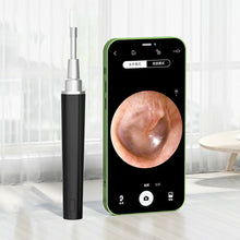 Load image into Gallery viewer, Soft Rechargeable Intelligent Wireless Visual Ear Pick Luminous HD Ear Endoscope Silicone Ear Spoon Ear Wax Cleaning Tool