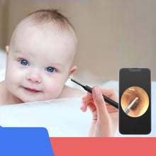 Load image into Gallery viewer, Visual Ear Digging Spoon Luminous Ear Spoon Universal High-definition Visual Ear Endoscope for Adults and Children