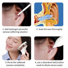 Load image into Gallery viewer, Earwax Electric Ear Water Ear Wax Cleaner Removal Irrigation System Safety Ear Washer Cleaning Adults Kids Ear Cleaner Kits