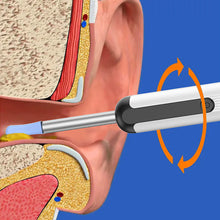 Load image into Gallery viewer, Intelligent Visual Ear Digging Spoon Wireless WIFI Charging Visual Ear Digging Spoon Earwax Ear Cleaning Tools