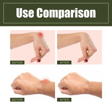 Load image into Gallery viewer, Cold Compress of Tendon Sheath Gel Spray To Relieve Pain of Wrist Tendon Sheath Joint Massage Nursing Spray Health Care