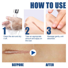 Load image into Gallery viewer, Skin Repair Cream Scar Cream Care for Scalds Burn Marks Acne Marks Fading and Smoothing Care Cream Scar Cream
