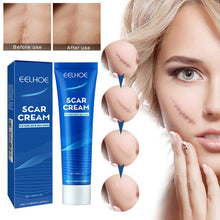 Load image into Gallery viewer, Skin Repair Cream Scar Cream Care for Scalds Burn Marks Acne Marks Fading and Smoothing Care Cream Scar Cream