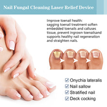 Load image into Gallery viewer, Gray Nail Care Device Gray Nail Fungus Cleaning and Care Device Mini Onychomycosis Treatment Fungal Nail Laser Device