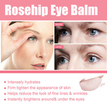 Load image into Gallery viewer, Rose Fruit Eye Cream Stick Reduces Eye Bags Fine Lines Moisturizes and Tightens The Skin Around The Eyes Skin Care