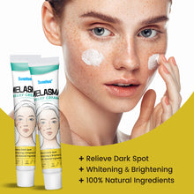Load image into Gallery viewer, Facial Fade Spots Cream Treating Melasma Facial Beauty and Freckle Lightening Cream Melasma Relief Cream Skin Care Products