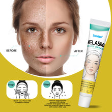 Load image into Gallery viewer, Facial Fade Spots Cream Treating Melasma Facial Beauty and Freckle Lightening Cream Melasma Relief Cream Skin Care Products