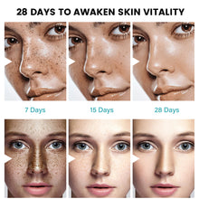 Load image into Gallery viewer, Facial Fade Spots Cream Treating Melasma Facial Beauty and Freckle Lightening Cream Melasma Relief Cream Skin Care Products