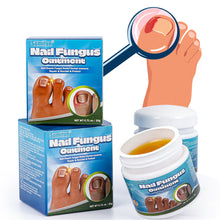Load image into Gallery viewer, Nail Fungus Ointment Remove Paronychia Eliminate Ingrown Nail Moisturize Skin Repair Toenails Foot Care Cream Health Care