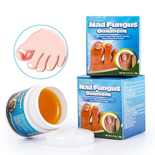 Load image into Gallery viewer, Nail Fungus Ointment Remove Paronychia Eliminate Ingrown Nail Moisturize Skin Repair Toenails Foot Care Cream Health Care