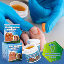 Load image into Gallery viewer, Nail Fungus Ointment Remove Paronychia Eliminate Ingrown Nail Moisturize Skin Repair Toenails Foot Care Cream Health Care