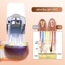 Load image into Gallery viewer, Portable Digital Display Nail Fungus Laser Device Onychomycosis Repair Fungal Cleaning Laser Care Device Onychomycosis Fungus Lamp