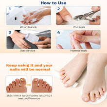 Load image into Gallery viewer, Portable Digital Display Nail Fungus Laser Device Onychomycosis Repair Fungal Cleaning Laser Care Device Onychomycosis Fungus Lamp