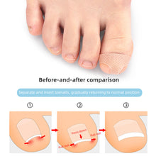 Load image into Gallery viewer, T-shaped Nail Sticker Ingrown Toenail Correction Patch Elastic Stretch Paronychia Inlaid Nail Restoration Patch Nail Care Tool