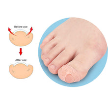 Load image into Gallery viewer, T-shaped Nail Sticker Ingrown Toenail Correction Patch Elastic Stretch Paronychia Inlaid Nail Restoration Patch Nail Care Tool