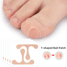 Load image into Gallery viewer, T-shaped Nail Sticker Ingrown Toenail Correction Patch Elastic Stretch Paronychia Inlaid Nail Restoration Patch Nail Care Tool