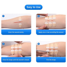Load image into Gallery viewer, 3Pcs/set Band-Aid Zipper Tie Wound Closure Patch Hemostatic Patch Wound Fast Suture Zipper Band-Aid Outdoor Portable