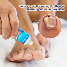 Load image into Gallery viewer, Mild Onychomycosis Cream Onychomycosis Care Repair Cream Toenail Onychomycosis Cream Nail Care Cream Health Care