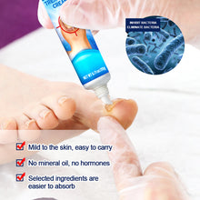 Load image into Gallery viewer, Mild Onychomycosis Cream Onychomycosis Care Repair Cream Toenail Onychomycosis Cream Nail Care Cream Health Care