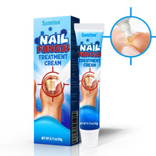 Load image into Gallery viewer, Mild Onychomycosis Cream Onychomycosis Care Repair Cream Toenail Onychomycosis Cream Nail Care Cream Health Care