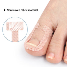 Load image into Gallery viewer, U-shaped Nail Stickers Paronychia Ingrown Toenail Correction Patches Elastic Stretching Onychocryptosis Restoration Patches