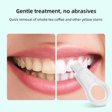 Load image into Gallery viewer, Tooth Cleaning Sponge Wipe Whiten Teeth Remove Tartar Micron Fiber Sponge Wipe Gentle Care Dental Cleaning Tool