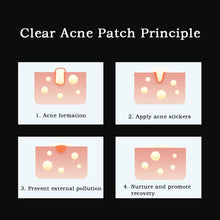 Load image into Gallery viewer, 24patches/sheet Cat Color Acne Patch PE Bag Containing Small Batch Covered Cartoon Acne Patch