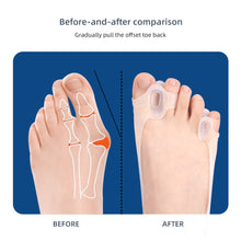 Load image into Gallery viewer, Thumb Valgus Tension Band Bigfoot Bone Overlapping Double Hole Toe Separator Flexible Wear-resistant Thumb Valgus Corrector
