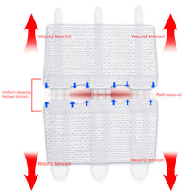 Load image into Gallery viewer, Suture Free Latches Pull-together Self-adhesive Bandage Independent Packaging Non-woven Elastic Band Bandage Wound Care
